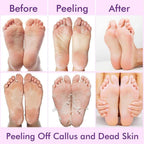 VisFort DermaPeel Socks “Transform Rough Feet Into Baby-Soft Skin”