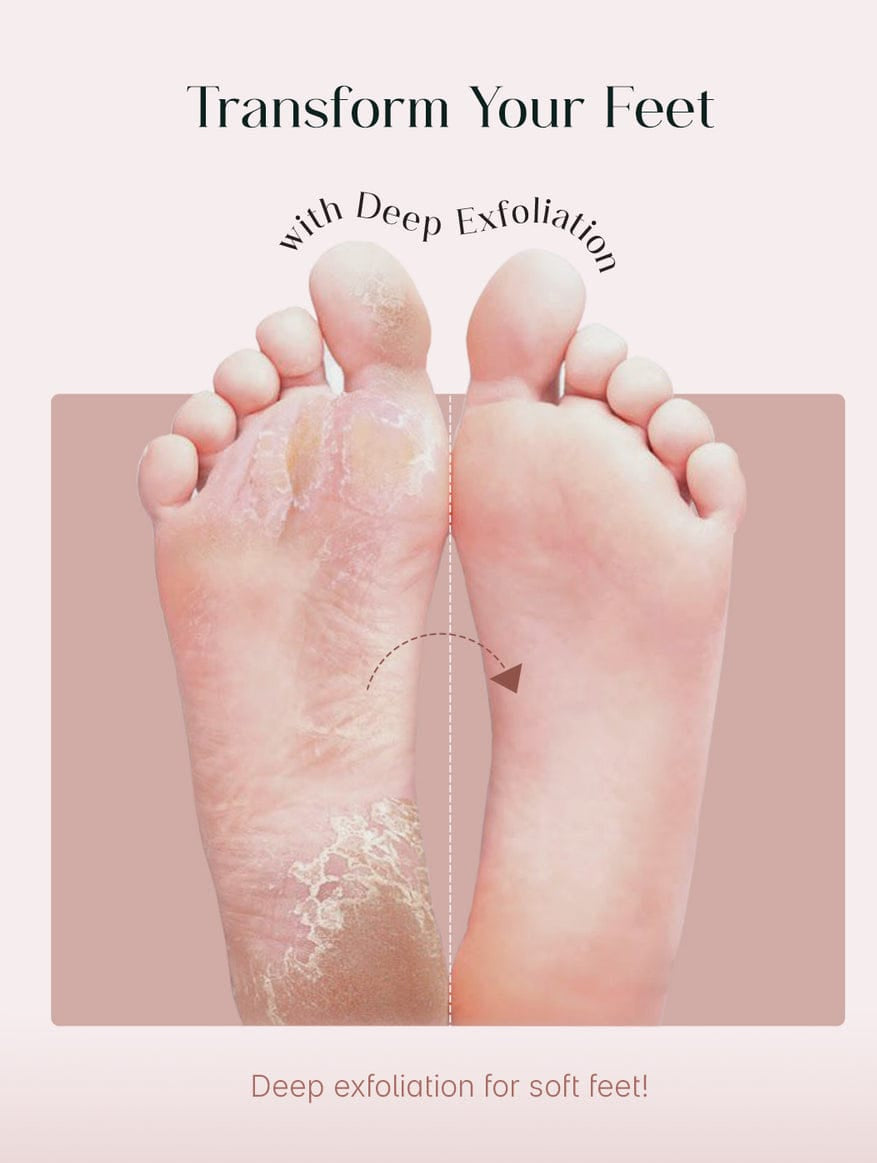 VisFort DermaPeel Socks “Transform Rough Feet Into Baby-Soft Skin”