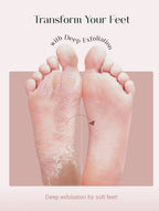 VisFort DermaPeel Socks “Transform Rough Feet Into Baby-Soft Skin”